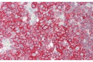 Immunohistochemistry (IHC) image for anti-Butyrylcholinesterase (BCHE) (AA 29-150) antibody (ABIN7434839)