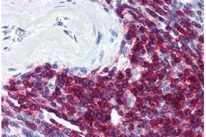 Human Spleen (formalin-fixed, paraffin-embedded) stained with CD5 antibody ABIN298515 at 20 ug/ml followed by biotinylated anti-mouse IgG secondary antibody ABIN481714, alkaline phosphatase-streptavidin and chromogen. (CD5 抗体)
