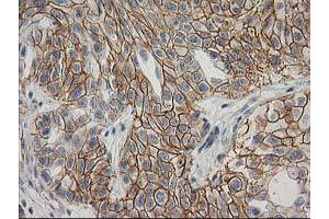 Image no. 1 for anti-Catenin (Cadherin-Associated Protein), beta 1, 88kDa (CTNNB1) antibody (ABIN1496888) (CTNNB1 抗体)