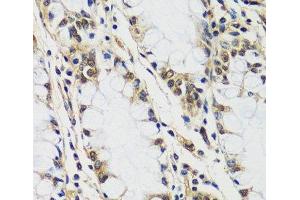 Immunohistochemistry of paraffin-embedded Human colon using CASC5 Polyclonal Antibody at dilution of 1:100 (40x lens). (CASC5 抗体)