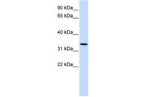 WB Suggested Anti-WNT6 Antibody Titration:  0. (WNT6 抗体  (Middle Region))