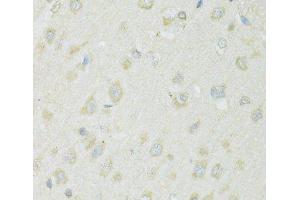 Immunohistochemistry of paraffin-embedded Rat brain using SLC22A5 Polyclonal Antibody at dilution of 1:100 (40x lens). (SLC22A5 抗体)