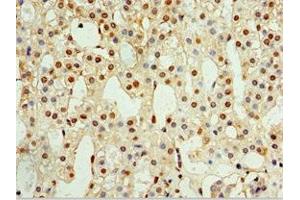 Immunohistochemistry of paraffin-embedded human adrenal gland tissue using ABIN7146290 at dilution of 1:100 (CALCB 抗体  (AA 1-127))