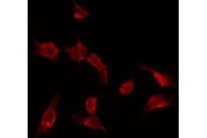 ABIN6275733 staining HepG2 by IF/ICC. (RNF113B 抗体  (Internal Region))