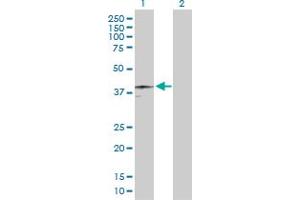 Western Blot analysis of HFE expression in transfected 293T cell line by HFE MaxPab polyclonal antibody. (HFE 抗体  (AA 1-348))