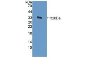 Detection of Recombinant PKR, Human using Polyclonal Antibody to Protein Kinase R (PKR) (EIF2AK2 抗体  (AA 224-502))