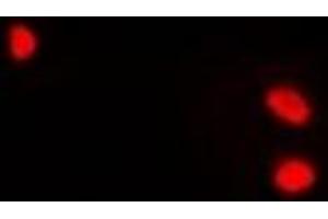 Immunofluorescence (IF) image for anti-Solute Carrier Family 11 (Proton-Coupled Divalent Metal Ion Transporters), Member 1 (SLC11A1) antibody (ABIN7306426)