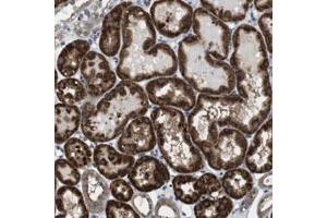 Immunohistochemical staining of human kidney with CD34 polyclonal antibody  shows strong cytoplasmic positivity in cells of tubules at 1:50-1:200 dilution. (CDC34 抗体)