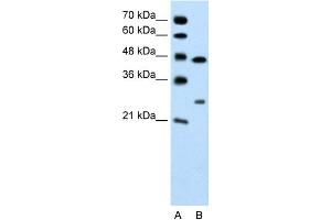 WB Suggested Anti-CLDN18 Antibody Titration: 0. (Claudin 18 抗体  (C-Term))