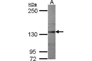 Western Blotting (WB) image for anti-Sema Domain, Seven thrombospondin Repeats (Type 1 and Type 1-Like), Transmembrane Domain (TM) and Short Cytoplasmic Domain, (Semaphorin) 5A (SEMA5A) (AA 700-1000) antibody (ABIN1501911) (SEMA5A 抗体  (AA 700-1000))