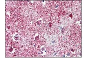 Immunohistochemistry: TAOK1 antibody staining of Formalin-Fixed, Paraffin-Embedded Human Brain, Cortex. (TAO Kinase 1 (TAOK1) (C-Term) 抗体)