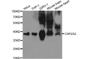 Western blot analysis of extracts of various cell lines, using CAPZA2 antibody (ABIN5971085) at 1/1000 dilution. (CAPZA2 抗体)