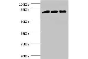 Western blot All lanes: DGKA antibody at 6. (DGKA 抗体  (AA 1-200))