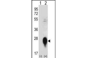 Western blot analysis of CLEC3B (arrow) using rabbit polyclonal CLEC3B Antibody (Center) (ABIN656570 and ABIN2845832). (CLEC3B 抗体  (AA 95-122))