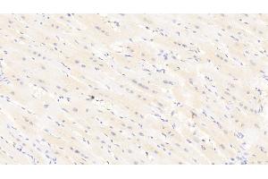 Detection of LEPR in Human Cardiac Muscle Tissue using Polyclonal Antibody to Leptin Receptor (LEPR) (Leptin Receptor 抗体  (AA 310-539))