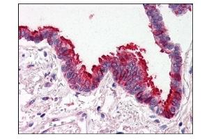 Image no. 1 for anti-SKI-Like Oncogene (SKIL) (N-Term) antibody (ABIN303248) (SKIL 抗体  (N-Term))