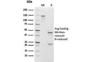 SDS-PAGE Analysis Purified IgM Recombinant Mouse Monoclonal Antibody (rIGHM/1623). (Recombinant IGHM 抗体)
