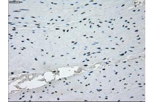 Immunohistochemical staining of paraffin-embedded endometrium tissue using anti-KDM4C mouse monoclonal antibody. (KDM4C 抗体)
