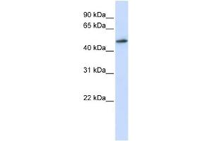 RNMT antibody used at 1 ug/ml to detect target protein. (RNMT 抗体)