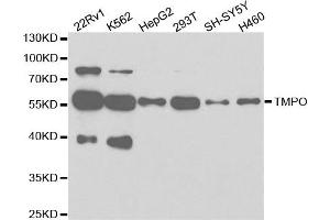 Western Blotting (WB) image for anti-Thymopoietin (TMPO) antibody (ABIN1875122) (Thymopoietin 抗体)