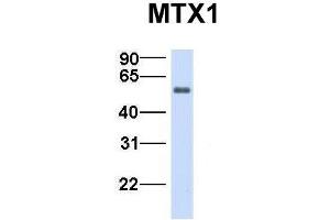 Host:  Rabbit  Target Name:  MTX1  Sample Type:  Human Fetal Heart  Antibody Dilution:  1.