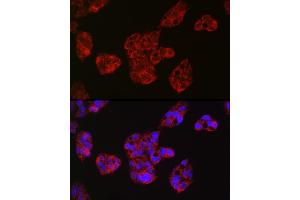 Immunofluorescence analysis of HepG2 cells using Leptin Receptor Rabbit pAb (ABIN3017145, ABIN3017146, ABIN3017147 and ABIN6219976) at dilution of 1:50 (40x lens). (Leptin Receptor 抗体)