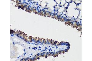 Immunohistochemistry of paraffin-embedded Mouse lung using SCGB1A1 Polyclonal Antibody at dilution of 1:100 (40x lens). (SCGB1A1 抗体)