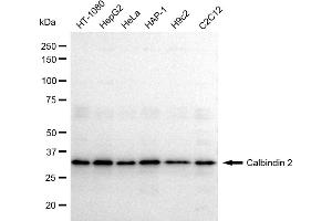 Western blotting analysis using Calbindin 2 antibody (ABIN7797824).