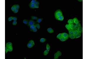 Immunofluorescence (IF) image for anti-Proteasome (Prosome, Macropain) 26S Subunit, Non-ATPase, 14 (PSMD14) (AA 264-283), (Regulatory Subunit 14) antibody (ABIN7139700)