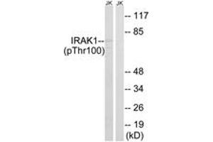Western blot analysis of extracts from Jurkat cells treated with heat shock, using IRAK1 (Phospho-Thr100) Antibody. (IRAK1 抗体  (pThr100))