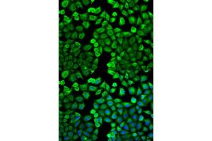 Immunofluorescence analysis of U2OS cells using HNMT antibody (ABIN5971352). (HNMT 抗体)