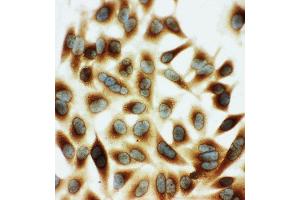 Anti-HSPB2 antibody, ICC ICC: HELA Cell (HSPB2 抗体  (Middle Region))