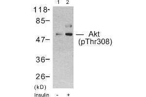 Western blot analysis using Akt (Phospho-Thr308) Antibody. (AKT1 抗体  (pThr308))