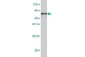 Western Blot detection against Immunogen (62. (NUDC 抗体  (AA 1-331))