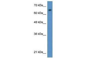 Western Blot showing WT1 antibody used at a concentration of 1-2 ug/ml to detect its target protein. (WT1 抗体  (N-Term))
