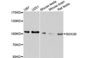 Western blot analysis of extracts of various cell lines, using SOX30 antibody. (SOX30 抗体  (AA 604-753))