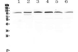 Western blot analysis of MVP using anti-MVP antibody . (MVP 抗体  (AA 2-259))