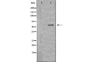 Western blot analysis of extracts from HeLa cells, using Dyskerin antibody. (DKC1 抗体  (Internal Region))