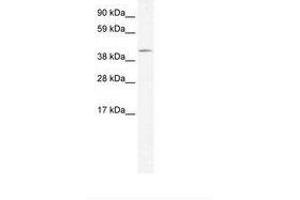 Image no. 2 for anti-Zinc Finger Protein 461 (ZNF461) (AA 26-75) antibody (ABIN203139) (ZNF461 抗体  (AA 26-75))
