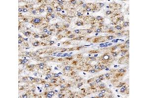 Immunohistochemistry analysis of paraffin-embedded human liver using,AGXT (ABIN7072987) at dilution of 1: 2000 (AGXT 抗体)
