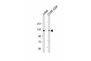 All lanes : Anti-GLI2 Antibody (C-term) at 1:2000 dilution Lane 1: Jurkat whole cell lysate Lane 2: CCRF-CEM whole cell lysate Lysates/proteins at 20 μg per lane. (GLI2 抗体  (C-Term))