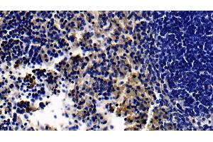 Detection of TLR5 in Mouse Spleen Tissue using Polyclonal Antibody to Toll Like Receptor 5 (TLR5) (TLR5 抗体  (AA 693-858))