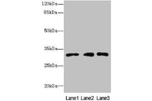 Western blot All lanes: PRDX4 antibody at 8 μg/mL Lane 1: HepG2 whole cell lysate Lane 2: Hela whole cell lysate Lane 3: 293T whole cell lysate Secondary Goat polyclonal to rabbit IgG at 1/10000 dilution Predicted band size: 31 kDa Observed band size: 31 kDa (Peroxiredoxin 4 抗体  (AA 38-271))
