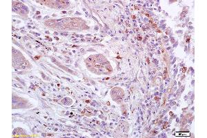Immunohistochemistry (IHC) image for anti-Signal Transducer and Activator of Transcription 3 (Acute-Phase Response Factor) (STAT3) (pSer727) antibody (ABIN746198)