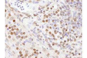 Immunohistochemistry (IHC) image for anti-Splicing Factor 3a, Subunit 1 (SF3A1) (AA 300-350) antibody (ABIN7449023)