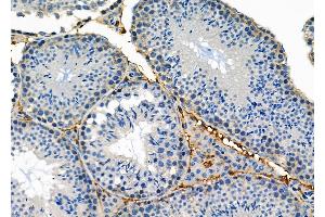 ABIN6258677 and ABIN6274898 at 1/100 staining Mouse testis tissue by IHC-P. (BNIP2 抗体  (Internal Region))