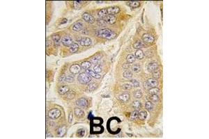 Immunohistochemistry (Paraffin-embedded Sections) (IHC (p)) image for anti-Nanos Homolog 1 (NANOS1) (AA 263-292), (C-Term) antibody (ABIN388159)