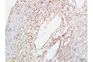 Formalin-fixed and paraffin embedded mouse uterus labeled with Anti-Smad3 (Ser423 + Ser425) Polyclonal Antibody, Unconjugated  at 1:200 followed by conjugation to the secondary antibody and DAB staining