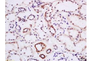 Formalin-fixed and paraffin embedded human kidney labeled with Anti-DTX3L Polyclonal Antibody, Unconjugated  at 1:200 followed by conjugation to the secondary antibody and DAB staining. (DTX3L 抗体  (AA 651-740))