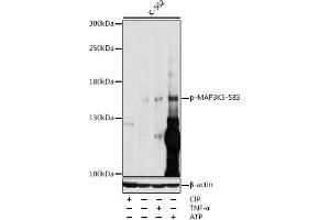 Western blot analysis of extracts of various cell lines, using Phospho-MK5-S83 antibody (ABIN3019487, ABIN3019488, ABIN3019489 and ABIN6225424) at 1:1000 dilution. (ASK1 抗体  (pSer83))